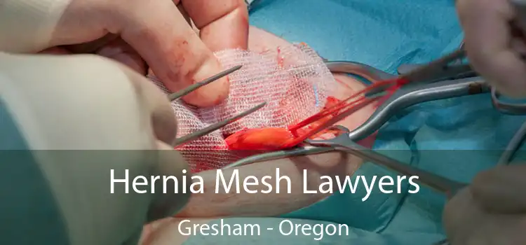 Hernia Mesh Lawyers Gresham - Oregon