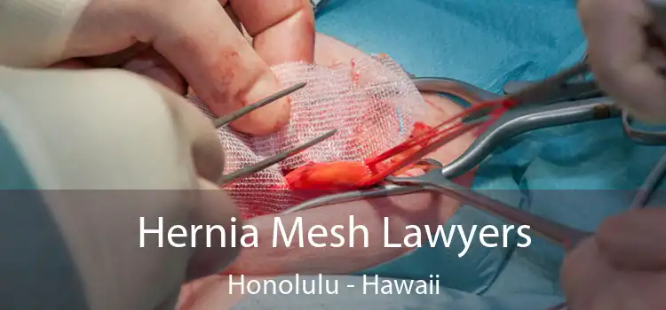 Hernia Mesh Lawyers Honolulu - Hawaii