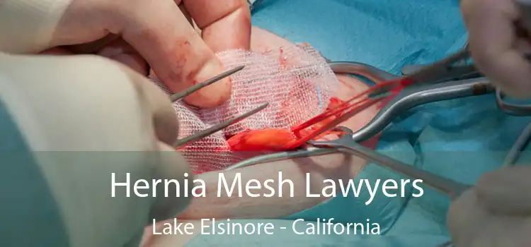 Hernia Mesh Lawyers Lake Elsinore - California