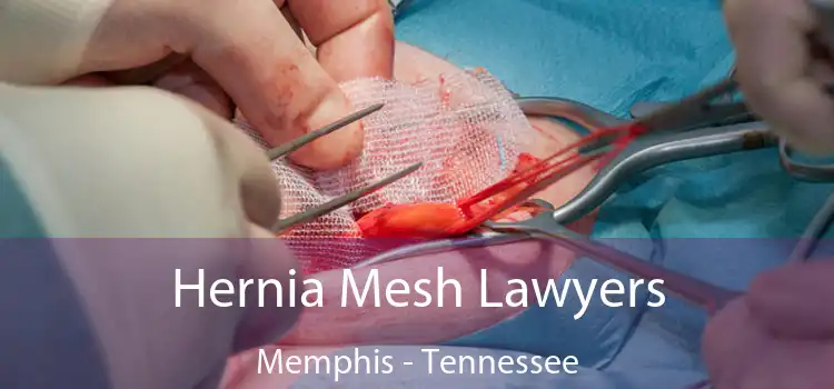 Hernia Mesh Lawyers Memphis - Tennessee