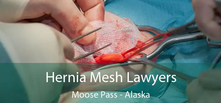 Hernia Mesh Lawyers Moose Pass - Alaska