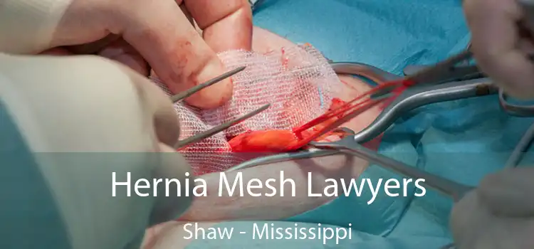 Hernia Mesh Lawyers Shaw - Mississippi