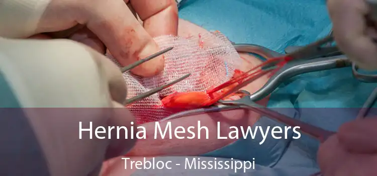 Hernia Mesh Lawyers Trebloc - Mississippi